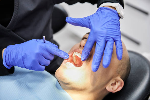 Best Emergency Broken Tooth Repair in Woodson Terrace, MO